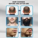 Titanium Adjustable Microneedling Derma Stamp | Professional Skin & Hair Care Tool for Face, Beard & Scalp (Reusable) - Image 7