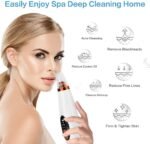 Electric 6-in-1 Blackhead Remover Vacuum | USB Rechargeable Acne & Pore Cleaner Device with 3 Suction Levels (White) - Image 5