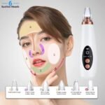 Electric 6-in-1 Blackhead Remover Vacuum | USB Rechargeable Acne & Pore Cleaner Device with 3 Suction Levels (White) - Image 4